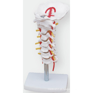 O modelo de simulação da banda carótida cervical